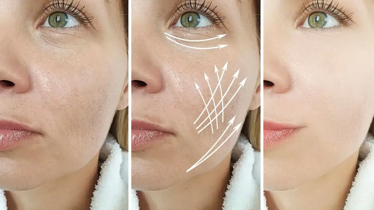 Can One Treatment Really Tackle More Than One Skin Concern Stamford?