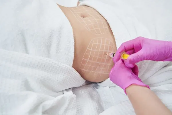 image of fat dissolving injections on love handles to help combat weight gain Stamford