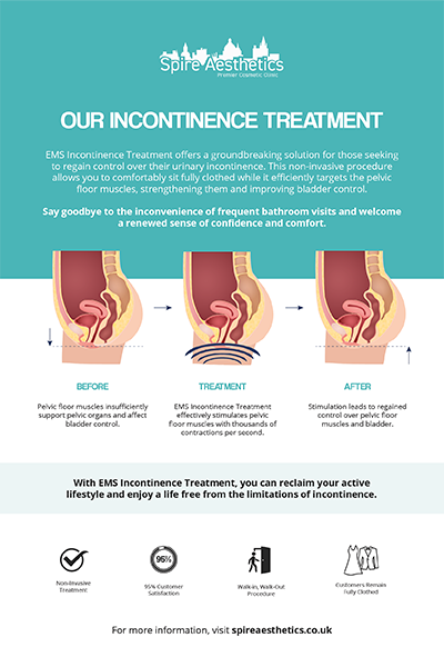 image of how urge incontinence Stamford treatment works