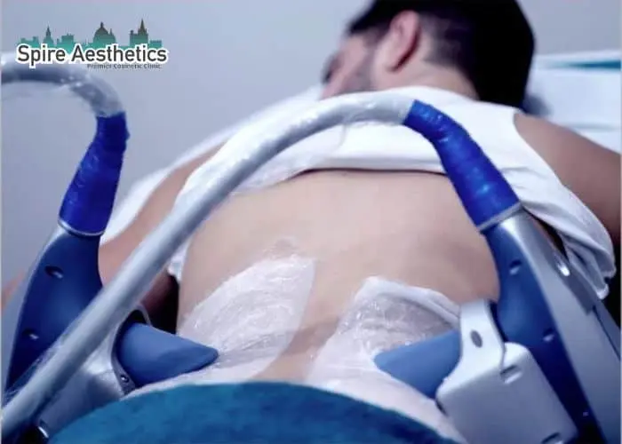 Man having fat freezing treatment done on love handles before a competitions Stamford to create a sculpted look.