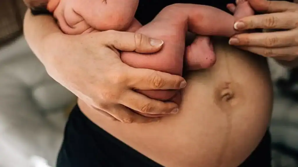 Why Is My Stomach Still Big After Pregnancy Stamford?